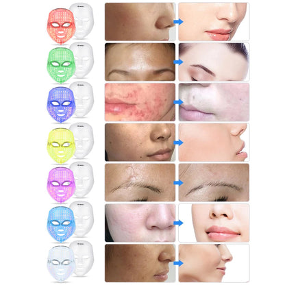 inSPORTline Face Mask Light Therapy Manahil